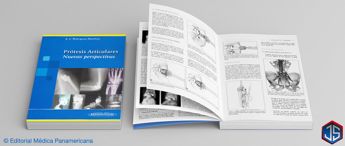 ProtesisArticularesEMP